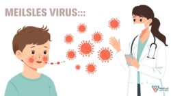 Kasus Campak Kembali Ditemukan di Sejumlah Daerah, Tenaga Kesehatan Ingatkan Pentingnya Deteksi Dini dan Vaksinasi