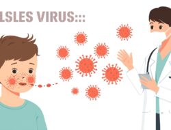 Kasus Campak Kembali Ditemukan di Sejumlah Daerah, Tenaga Kesehatan Ingatkan Pentingnya Deteksi Dini dan Vaksinasi